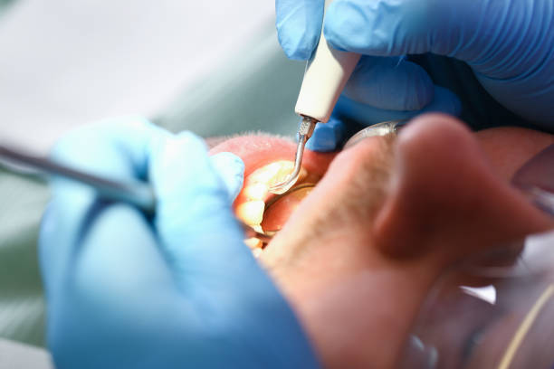 Best Emergency Dental Filling Replacement  in Crozet, VA