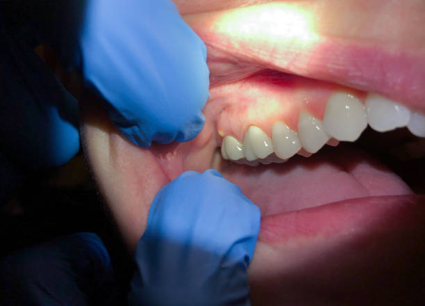 Best Teeth Whitening  in Crozet, VA